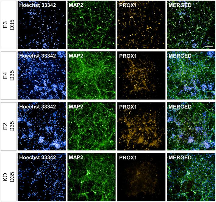 https://cdn.ncbi.nlm.nih.gov/pmc/blobs/56e0/10947111/2c7c994c0a1a/HIPO-33-322-g009.jpg