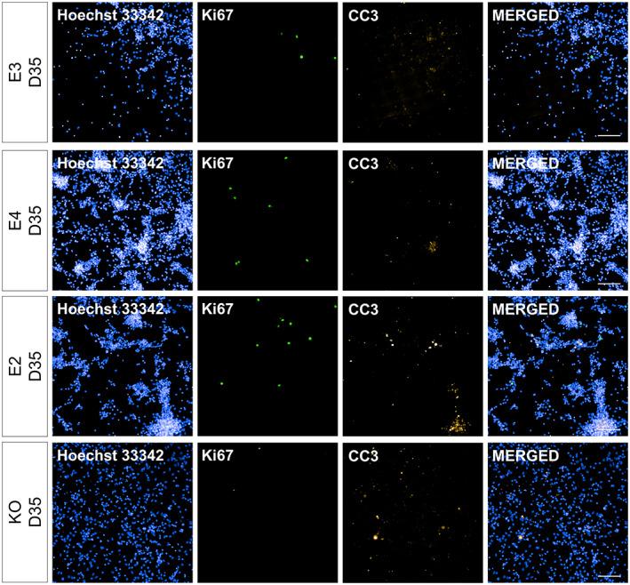 https://cdn.ncbi.nlm.nih.gov/pmc/blobs/56e0/10947111/45c6327bca92/HIPO-33-322-g005.jpg