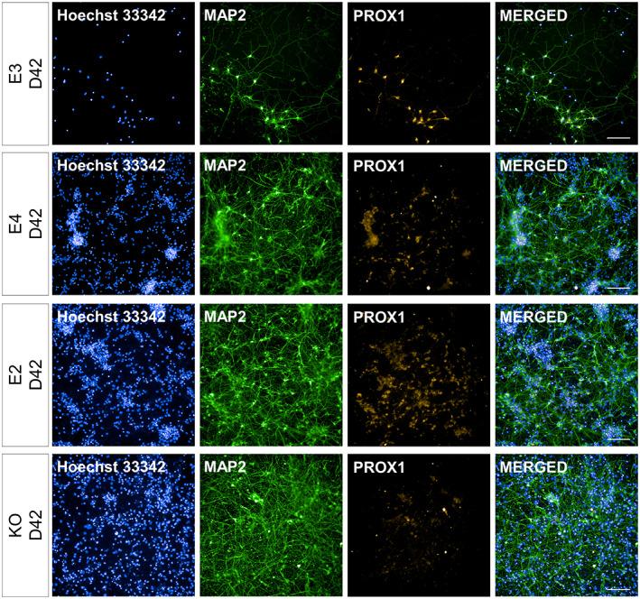 https://cdn.ncbi.nlm.nih.gov/pmc/blobs/56e0/10947111/de7d267cb4ab/HIPO-33-322-g011.jpg