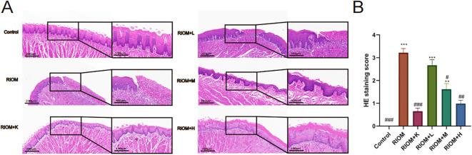 https://cdn.ncbi.nlm.nih.gov/pmc/blobs/56e2/11931053/83fa4d5e40dd/fimmu-16-1559400-g005.jpg