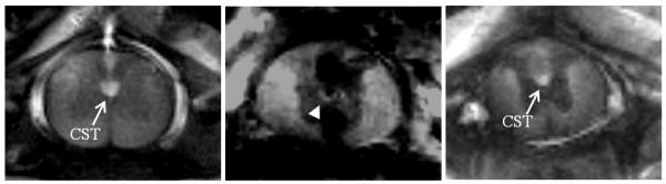 https://cdn.ncbi.nlm.nih.gov/pmc/blobs/56e6/1660558/63a4fe1dee89/1471-2342-6-15-4.jpg