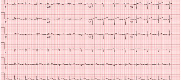 https://cdn.ncbi.nlm.nih.gov/pmc/blobs/56f6/12332228/175427b017c3/cureus-0017-00000087562-i01.jpg