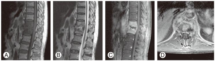 https://cdn.ncbi.nlm.nih.gov/pmc/blobs/56f8/3996349/8bd9444439bc/asj-8-216-g002.jpg