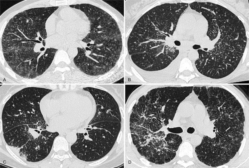 https://cdn.ncbi.nlm.nih.gov/pmc/blobs/56f9/6133449/688cc8082242/medi-97-e12205-g001.jpg