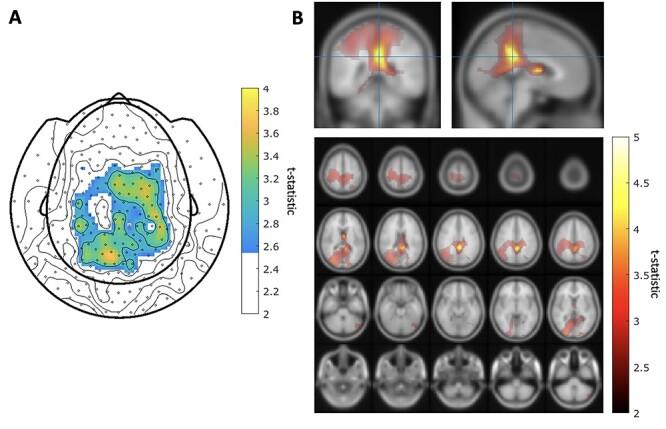 https://cdn.ncbi.nlm.nih.gov/pmc/blobs/56fa/9340400/7bd303a88f13/bhab417f3.jpg