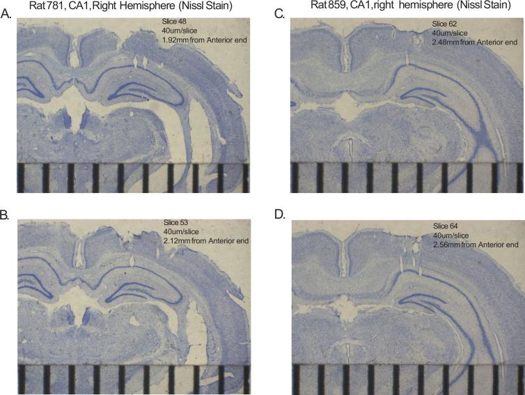 https://cdn.ncbi.nlm.nih.gov/pmc/blobs/56fd/12040320/060c7acf26c5/elife-85599-fig1-figsupp1.jpg