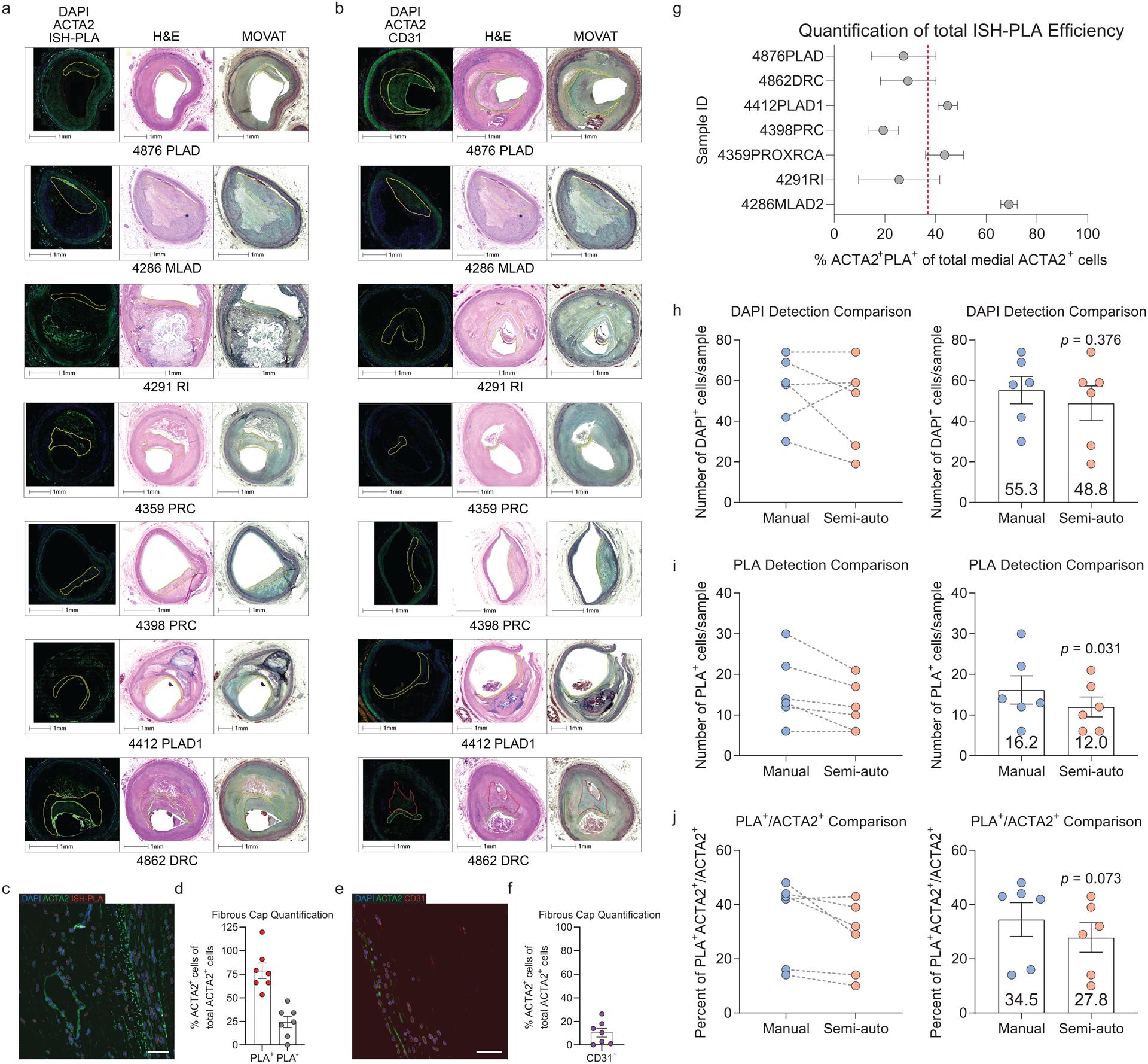 https://cdn.ncbi.nlm.nih.gov/pmc/blobs/5700/7905710/a7125de4c0b5/nihms-1657184-f0015.jpg