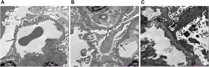 https://cdn.ncbi.nlm.nih.gov/pmc/blobs/5709/11162193/4198f12fd926/IJNRD-17-167-g0002.jpg