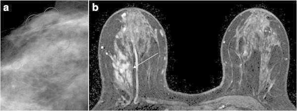 https://cdn.ncbi.nlm.nih.gov/pmc/blobs/5709/4409605/90721b44b894/40064_2014_1528_Fig1_HTML.jpg