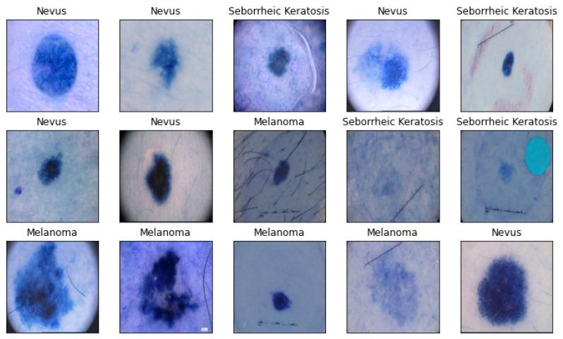 https://cdn.ncbi.nlm.nih.gov/pmc/blobs/570a/10778045/2cbb4b7534ee/cancers-16-00108-g001.jpg