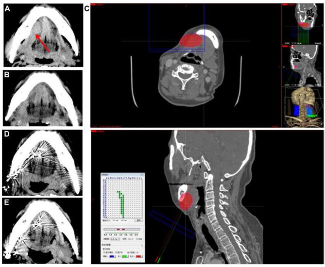 https://cdn.ncbi.nlm.nih.gov/pmc/blobs/570a/11391846/3732d193292f/12885_2024_12899_Fig5_HTML.jpg