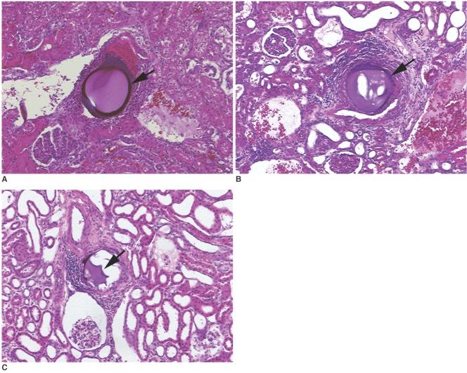 https://cdn.ncbi.nlm.nih.gov/pmc/blobs/570e/2626815/a6f0482cc7be/kjr-8-418-g006.jpg