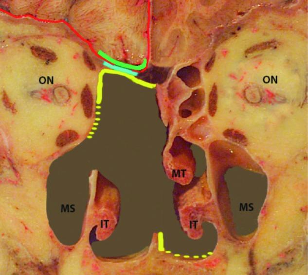 https://cdn.ncbi.nlm.nih.gov/pmc/blobs/5717/4977006/a822786d02ab/0392-100X-36-194-g002.jpg