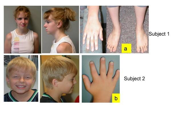 https://cdn.ncbi.nlm.nih.gov/pmc/blobs/571a/2648978/a1e9fb183dad/1755-8166-1-23-1.jpg
