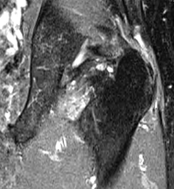 https://cdn.ncbi.nlm.nih.gov/pmc/blobs/571b/4427642/501c1819c9a6/gr3.jpg