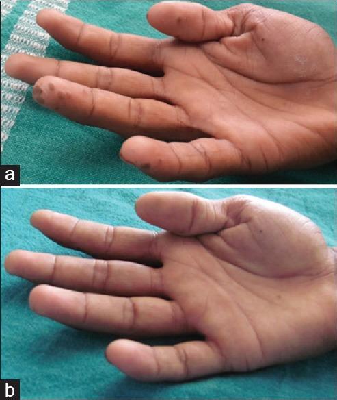 https://cdn.ncbi.nlm.nih.gov/pmc/blobs/571c/5561717/1ea24a7d5121/JCAS-10-90-g002.jpg