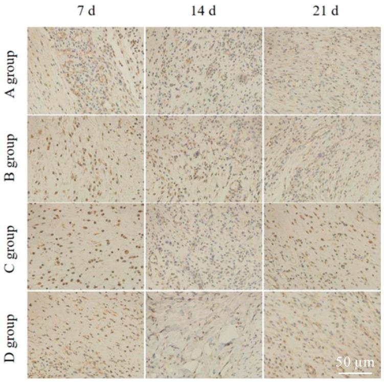 https://cdn.ncbi.nlm.nih.gov/pmc/blobs/571f/9689536/60880771ed9c/gels-08-00712-g004.jpg