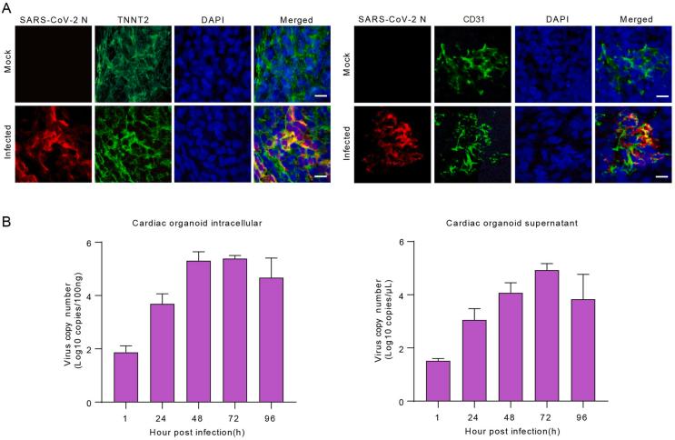 https://cdn.ncbi.nlm.nih.gov/pmc/blobs/5725/10786654/7b38cda34337/figs2.jpg
