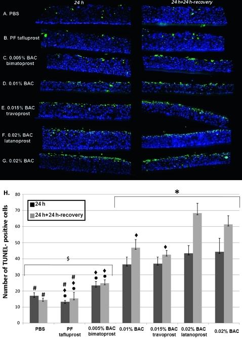 https://cdn.ncbi.nlm.nih.gov/pmc/blobs/572c/3099447/efc03bef14d6/bjophthalmol189449fig2.jpg
