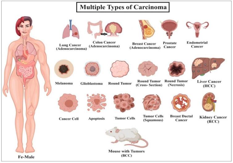 https://cdn.ncbi.nlm.nih.gov/pmc/blobs/5730/11956523/0a0dff52df05/EXCLI-24-407-g-001.jpg