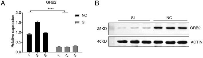 https://cdn.ncbi.nlm.nih.gov/pmc/blobs/5730/12086363/36672955e68a/CAM4-14-e70905-g004.jpg