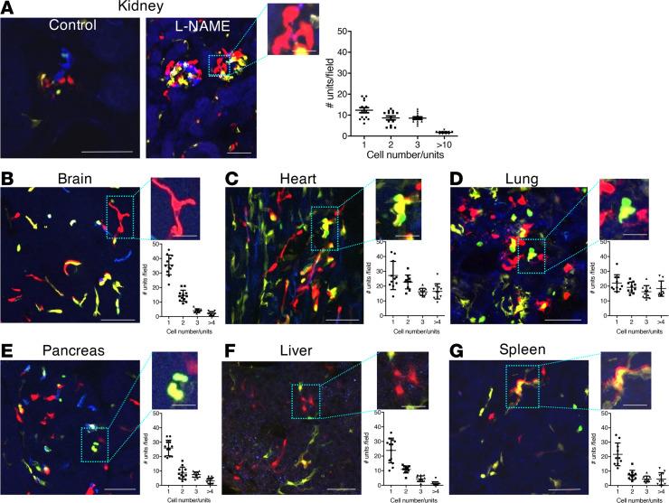 https://cdn.ncbi.nlm.nih.gov/pmc/blobs/5737/8262275/6c5cf6354183/jciinsight-6-123392-g136.jpg