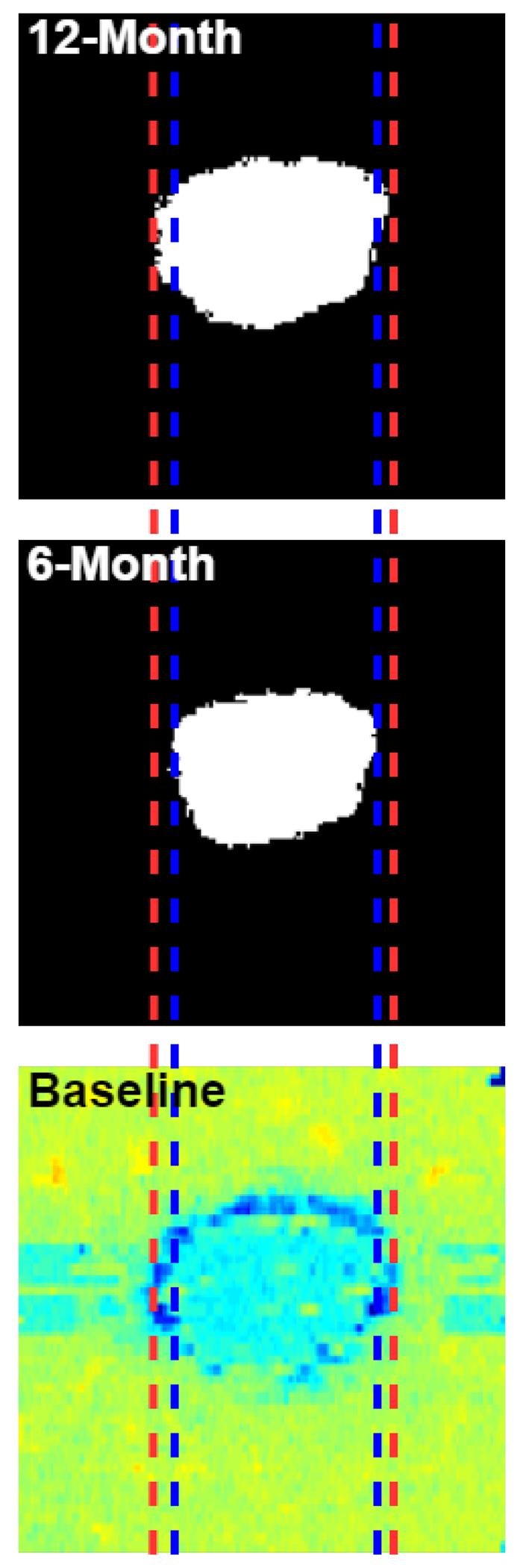 https://cdn.ncbi.nlm.nih.gov/pmc/blobs/5739/11288976/309496d6461b/nihms-1987998-f0006.jpg