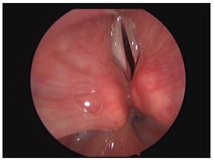 https://cdn.ncbi.nlm.nih.gov/pmc/blobs/5741/3884539/d2ccf4bd59e1/CTO-12-04-g-005.jpg