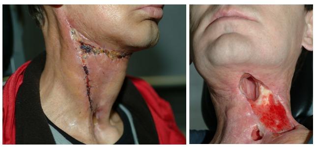 https://cdn.ncbi.nlm.nih.gov/pmc/blobs/5741/3884539/ee787c2f04c9/CTO-12-04-g-009.jpg