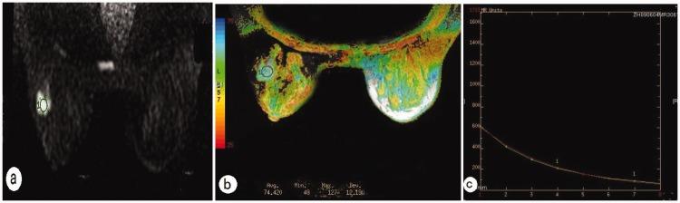 https://cdn.ncbi.nlm.nih.gov/pmc/blobs/5741/5991255/fadd3b90653b/10.1177_0300060517721071-fig2.jpg