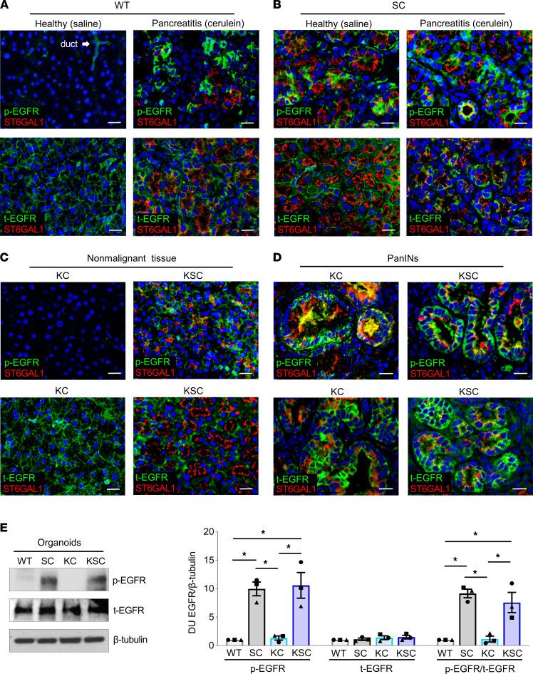 https://cdn.ncbi.nlm.nih.gov/pmc/blobs/5750/10619436/4fae920867d5/jciinsight-8-161563-g008.jpg
