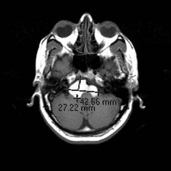 https://cdn.ncbi.nlm.nih.gov/pmc/blobs/5756/4199459/e1979ea6ff3f/poljradiol-79-356-g001.jpg