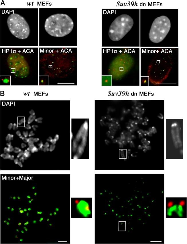 https://cdn.ncbi.nlm.nih.gov/pmc/blobs/5759/2172221/ce243f0a0e9c/200403109f7.jpg
