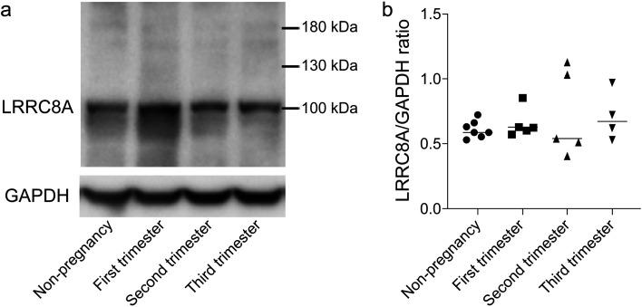 https://cdn.ncbi.nlm.nih.gov/pmc/blobs/575c/9130036/9e6ad790857b/expanim-71-123-g003.jpg