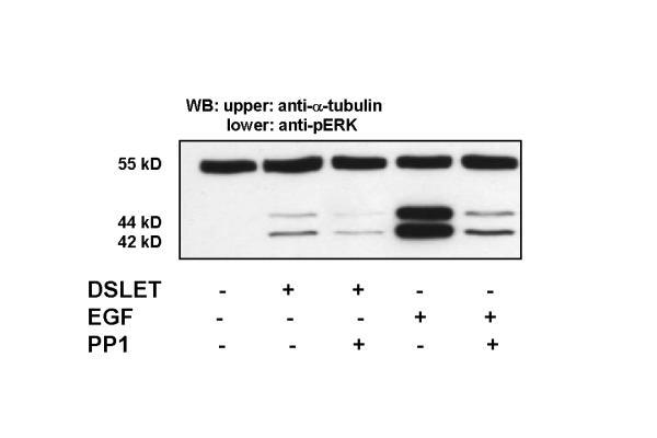 https://cdn.ncbi.nlm.nih.gov/pmc/blobs/5764/88976/bb362f123c4d/1471-2210-2-5-3.jpg