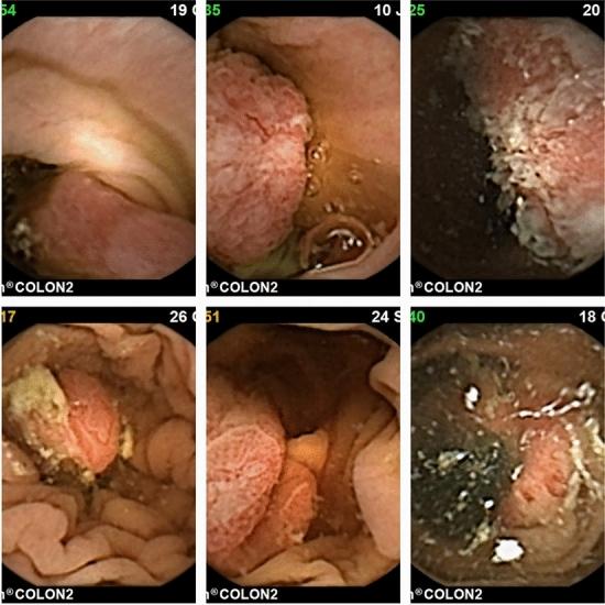 https://cdn.ncbi.nlm.nih.gov/pmc/blobs/5768/11836113/421e6ccdf8cd/41598_2025_89648_Fig3_HTML.jpg