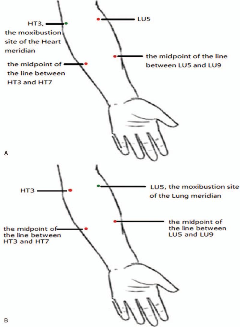 https://cdn.ncbi.nlm.nih.gov/pmc/blobs/5769/7220657/a5db6de08bed/medi-99-e19594-g004.jpg