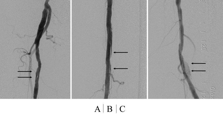 https://cdn.ncbi.nlm.nih.gov/pmc/blobs/576a/12078086/f51a8dd5fc14/2432-0935-10-e2024-0043-g007.jpg