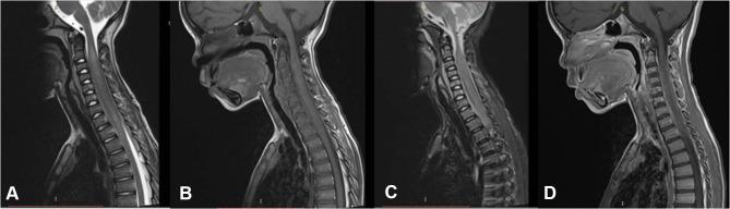 https://cdn.ncbi.nlm.nih.gov/pmc/blobs/576a/7781032/5cfb7e2212dd/IMCRJ-13-701-g0001.jpg