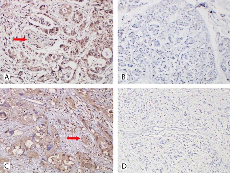 https://cdn.ncbi.nlm.nih.gov/pmc/blobs/576f/4272229/67ed8d34c489/mpa-44-134-g003.jpg