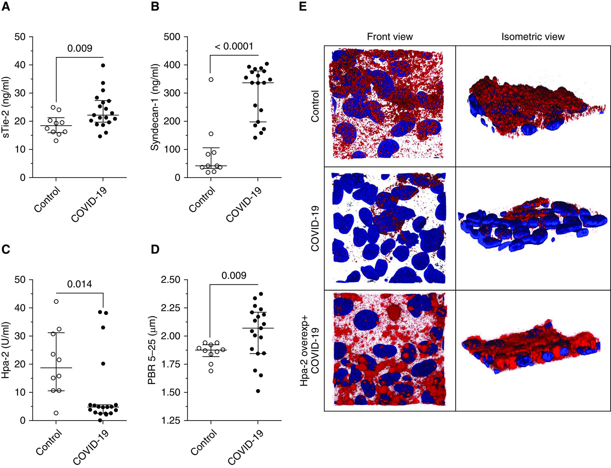 https://cdn.ncbi.nlm.nih.gov/pmc/blobs/5770/7560808/952601e76d02/rccm.202007-2676LEf1.jpg