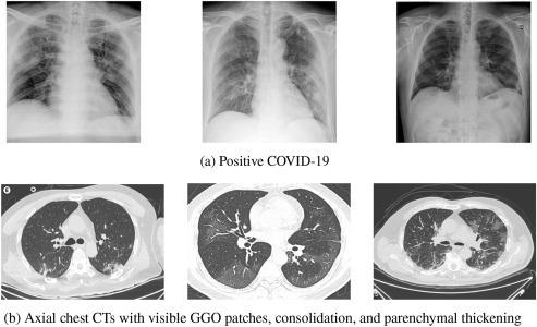 https://cdn.ncbi.nlm.nih.gov/pmc/blobs/5774/7531283/fd32ecc030dd/gr1.jpg