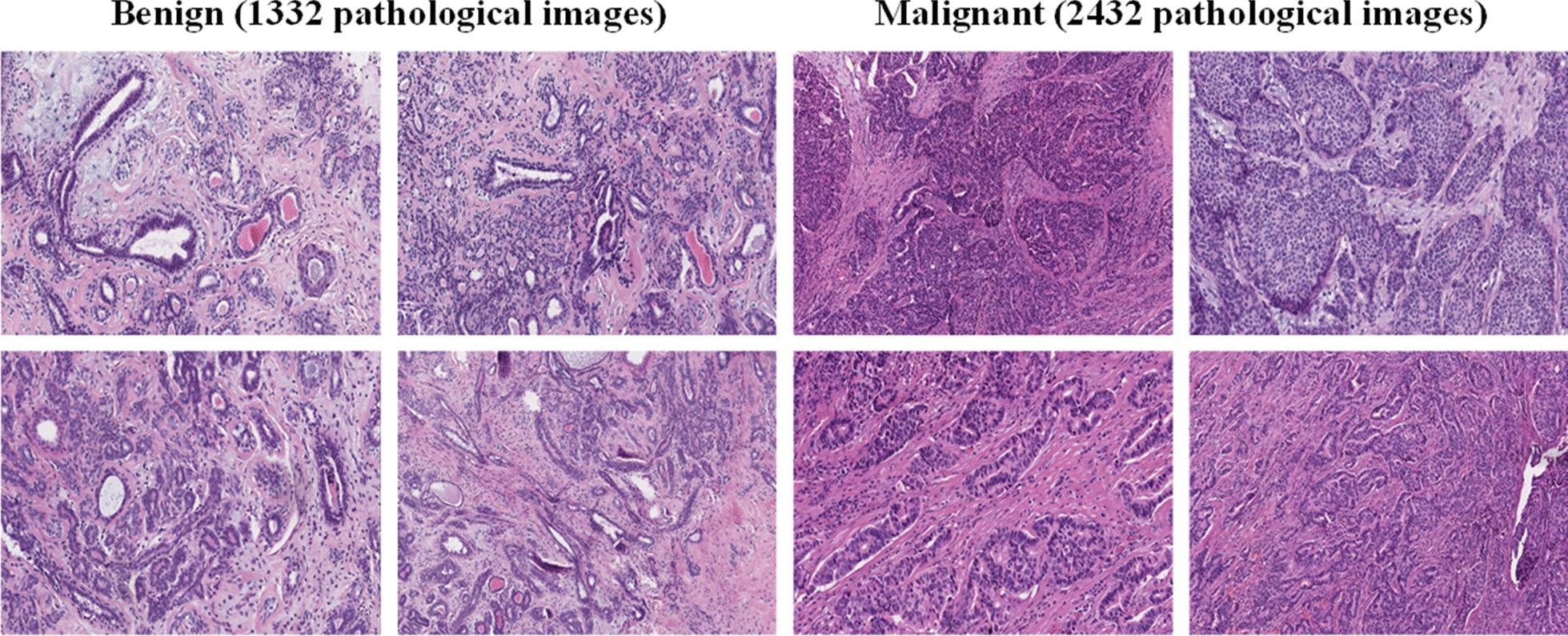 https://cdn.ncbi.nlm.nih.gov/pmc/blobs/5775/8061018/ed0a9e6a6060/12911_2020_1340_Fig2_HTML.jpg