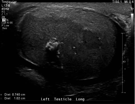 https://cdn.ncbi.nlm.nih.gov/pmc/blobs/5775/8079193/730ba7c8d087/CRIU2021-6692578.001.jpg