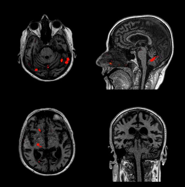 https://cdn.ncbi.nlm.nih.gov/pmc/blobs/577d/3355043/7b3d0c3dbd41/1757-7241-20-22-8.jpg