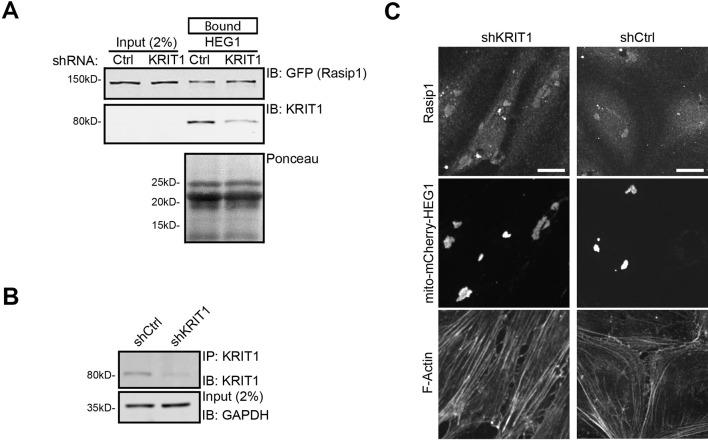 https://cdn.ncbi.nlm.nih.gov/pmc/blobs/577d/4733052/8fb92a90703c/elife-11394-fig2.jpg