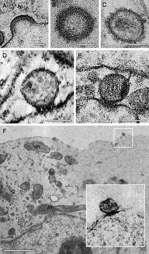 https://cdn.ncbi.nlm.nih.gov/pmc/blobs/5781/1876499/0762569bfcf7/ppat.0030063.g004.jpg