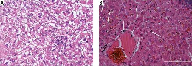 https://cdn.ncbi.nlm.nih.gov/pmc/blobs/5787/8284165/685e9a1af9cc/CEH-7-44119-g002.jpg