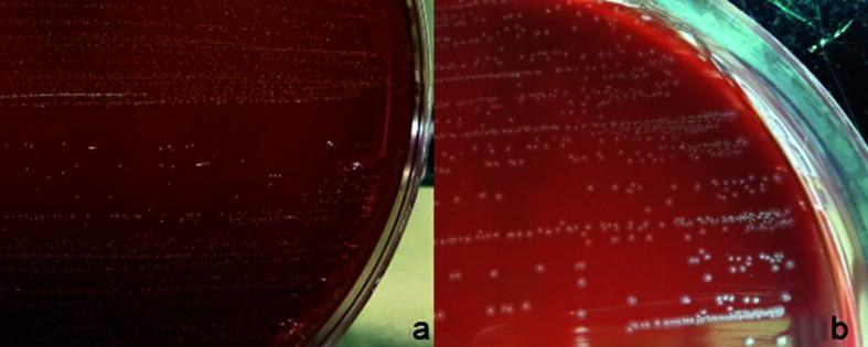 https://cdn.ncbi.nlm.nih.gov/pmc/blobs/5788/5857363/ae2ed9db0035/jmmcr-5-5137-g001.jpg