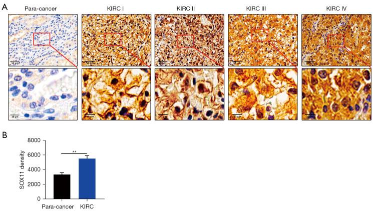 https://cdn.ncbi.nlm.nih.gov/pmc/blobs/5793/11319951/38037518255f/tcr-13-07-3536-f2.jpg